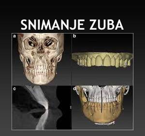 snimanje zuba